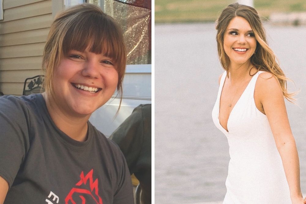 before and after weight loss
